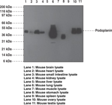 Podoplanin Monoclonal Antibody (Clone pmab-1) (Aggrus, gp38, T1A)
