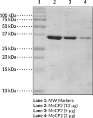 MeCP2 (human recombinant; methyl binding domain aa 77-166) (Methyl-CpG Binding Protein 2)