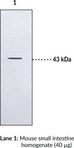 BLT2 Receptor Polyclonal Antibody (BLTR2, Leukotriene B4 Receptor 2, LTB4 Receptor 2)