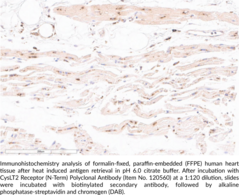 CysLT2 Receptor (N-Term) Polyclonal Antibody (Cysteinyl-Leukotriene Receptor 2, CysLTR2)