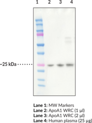 ApoA1 Monoclonal Antibody (Clone CC3821C4) (Apolipoprotein A1)