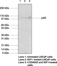 Androgen Receptor (Phospho-Ser210,213) Monoclonal Antibody (Clone 156C135.2) (AR, NR3C4, Nuclear Receptor Subfamily 3 Group C Member 4)
