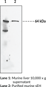 Soluble Epoxide Hydrolase (FL) Polyclonal Antibody (Cytosolic Epoxide Hydrolase (CEH), EPHX2, Epoxide Hydrolase 2, sEH)