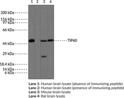 TIP60 Polyclonal Antibody