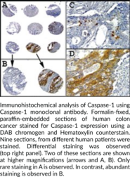 Caspase-1 Monoclonal Antibody (Clone 14F468)
