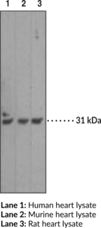 Caspase-3 Monoclonal Antibody (Clone 31A1067) (Apopain, CPP32, ICE3, Yama)