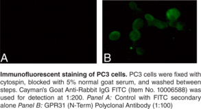 GPR31 (N-Term) Polyclonal Antibody (12-(S)-hydroxy-5,8,10,14-Eicosatetraenoic Acid Receptor, G Protein-Coupled Receptor 31, 12-HETER, 12(S)-HETE Receptor)
