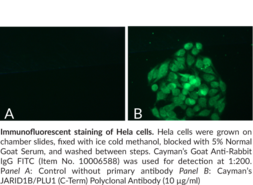 JARID1B/PLU1 (C-Term) Polyclonal Antibody (CT31, Jumonji/ARID domain-containing protein 1B, KDM5B, Lysine-specific Demethylase 5B, RBBP2H1)