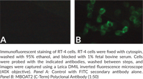 MBOAT2 (C-Term) Polyclonal Antibody