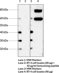 HHATL Polyclonal Antibody (C3orf3, Glycerol Uptake Transporter Homolog, GUP1, Hedgehog Acyltransferase-like Protein, KIAA1173, MBOAT3, MSTP002, OACT3, Protein-Cysteine N-Palmitoyltransferase HHAT-like Protein)
