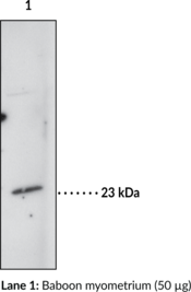 Prostaglandin D Synthase (hematopoietic-type) Polyclonal Antibody (H-PGDS, H-PGD Synthase)