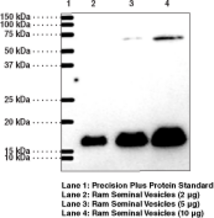 Prostaglandin E Synthase-1 (microsomal) Polyclonal Antibody (Membrane-Associated PGES-1, MGST1-L1, mPGES-1, mPGE Synthase-1, PIG12, Prostaglandin H/E Isomerase)