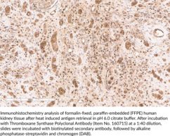Thromboxane Synthase Polyclonal Antibody