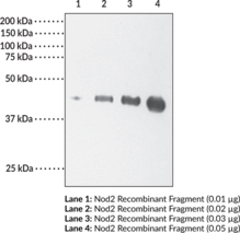 Nod2 Polyclonal Antibody (Caspase recruitment domain-containing protein 15, Inflammatory bowel disease protein 1, Nucleotide-binding oligomerization domain-containing protein 2)
