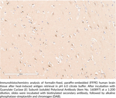 Guanylate Cyclase β1 subunit (soluble) Polyclonal Antibody