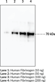 Fibrinogen (α chain) Monoclonal Antibody (Clone 6D6) (FGA)