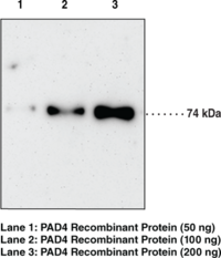 PAD4 Monoclonal Antibody (Clone 11F9) (HL-60 PAD, PADI4, Peptidylarginine Deiminase IV, Protein-arginine Deiminase type-4)