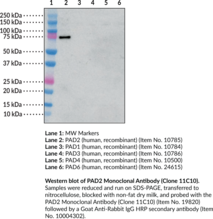 PAD2 Monoclonal Antibody (Clone 11C10) (PADI2, PAD-H19, Peptidylarginine Deiminase 2, Protein-Arginine Deiminase 2)