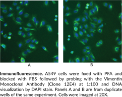 Vimentin Monoclonal Antibody (Clone 12E4)