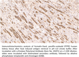α-Enolase Polyclonal Antibody
