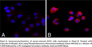 Phosphothreonine Monoclonal Antibody (Clone RM102)