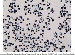 Histone H3K27Me3 Monoclonal Antibody (Clone RM175)