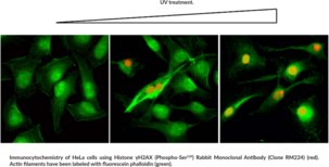 Histone γH2AX (Phospho-Ser139) Rabbit Monoclonal Antibody (Clone RM224)