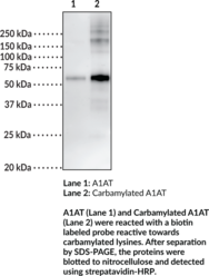 Carbamylated Alpha-1 Antitrypsin (Carbamylated A1A, Carbamylated A1AT, Carbamylated AAT, Carbamylated α1-Antitrypsin)