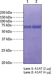 Carbamylated Alpha-1 Antitrypsin