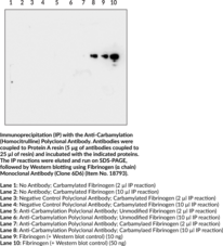 Anti-Carbamylation (Homocitrulline) Polyclonal Antibody