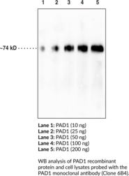 PAD1 Monoclonal Antibody (Clone 6B4) (PADI1, PDI1, Peptidylarginine Deiminase 1, Protein Arginine Deiminase 1)