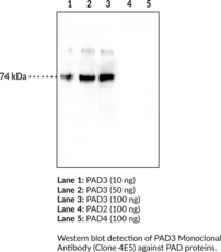 PAD3 Monoclonal Antibody (Clone 4E5) (PADI3, PDI3, Peptidylarginine Deiminase 3, Protein Arginine Deiminase 3)