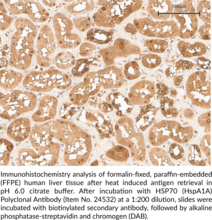 Hsp70 (HspA1A) Polyclonal Antibody