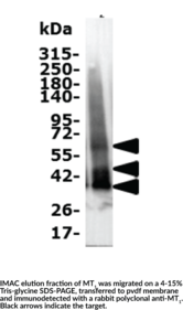 Melatonin Receptor Type 1A (human recombinant)