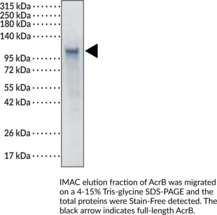 AcrB (E. coli K12)