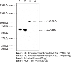 RIG-I Monoclonal Antibody (Clone 1E3) (Probable ATP-dependent RNA Helicase DDX58, DEAD Box Protein 58, Retinoic Acid-inducible Gene 1 Protein, RIG-I-like Receptor 1)