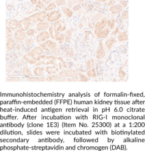 RIG-I Monoclonal Antibody (Clone 1E3)