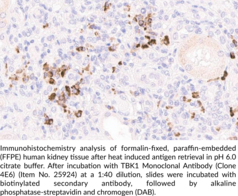 TBK1 Monoclonal Antibody (Clone 4E6)