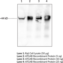 ATG4B Monoclonal Antibody (Clone 8A5) (hAPG4B, AUT-like 1 Cysteine Endopeptidase, Autophagin-1, Autophagy-related Protein 4 Homolog B, Cysteine Protease ATG4B)