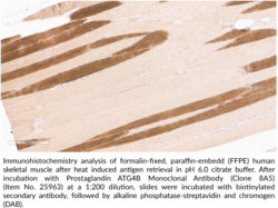 ATG4B Monoclonal Antibody (Clone 8A5)