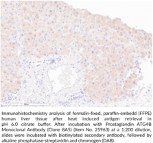 ATG4B Monoclonal Antibody (Clone 8A5)