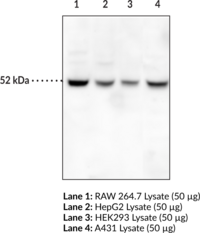 Beclin 1 Monoclonal Antibody (Clone 5F7) (BECN1, Coiled-coil Myosin-like Bcl-2-interacting Protein, Protein GT197)