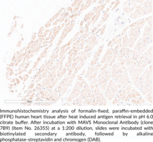 MAVS Monoclonal Antibody (Clone 7B9)