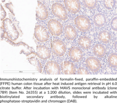 MAVS Monoclonal Antibody (Clone 7B9)
