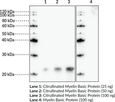 Citrullinated Myelin Basic Protein Polyclonal Antibody (citMBP, Citrullinated Myelin A1 Protein, Citrullinated Myelin Membrane Encephalitogenic Protein, Myelin A1 Protein, Myelin Membrane Encephalitogenic Protein)