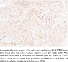 GPR18 (C-Term) Polyclonal Antibody (N-Arachidonyl Glycine Receptor, GPCRW, G Protein-Coupled Receptor 18, NAGly Receptor)