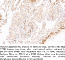 FPR2 (C-Term) Polyclonal Antibody