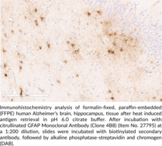 Citrullinated GFAP (R416) Monoclonal Antibody (Clone 4B8)