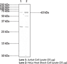 YTHDF2 Polyclonal Antibody (CLL-associated Antigen KW-14, HGRG8, High-glucose-regulated Protein 8, Renal Carcinoma Antigen NY-REN-2, YTH Domain-containing Family Protein 2)