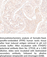 YTHDF2 Polyclonal Antibody